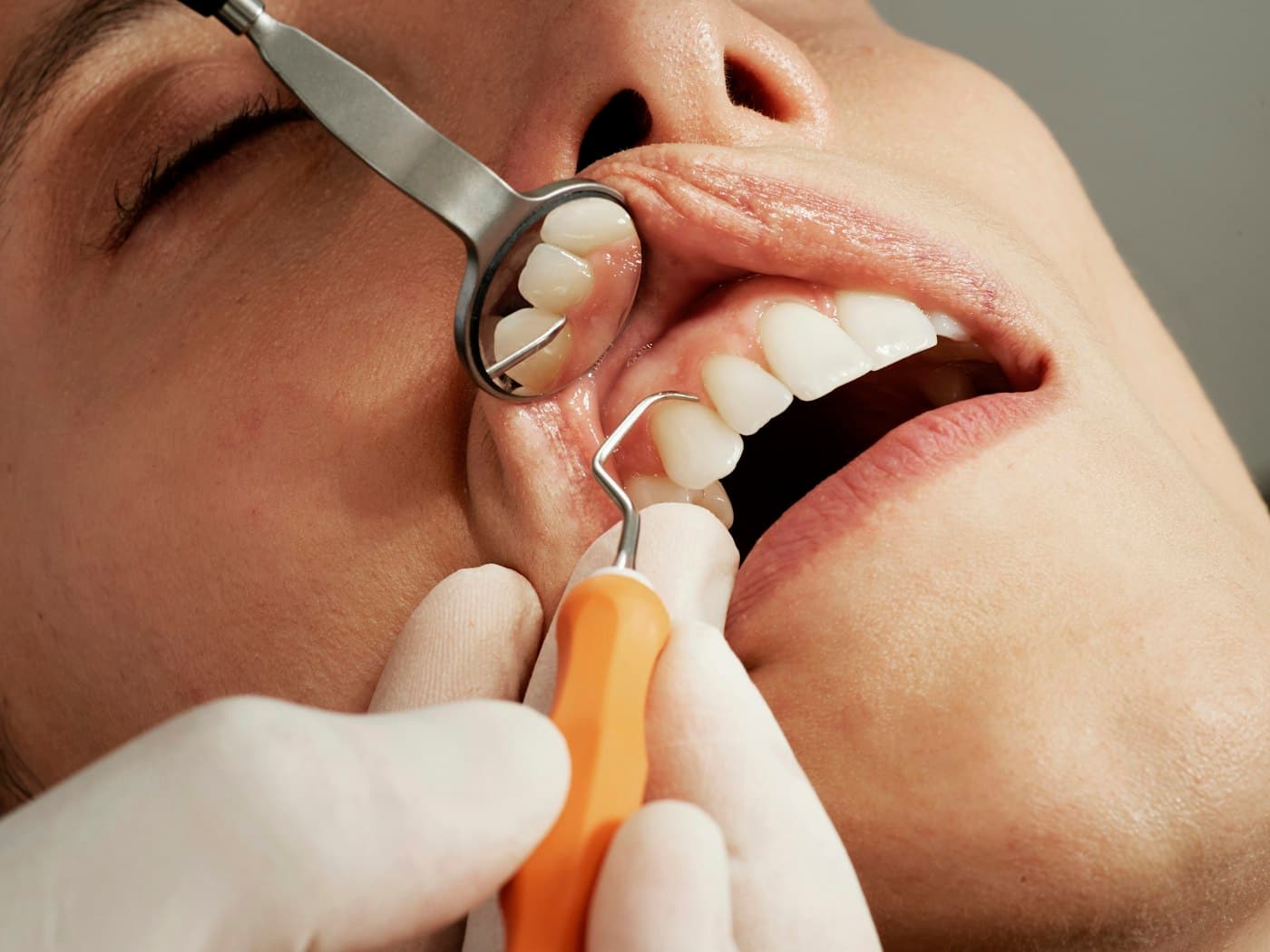 Close-up of a professional dental cleaning
