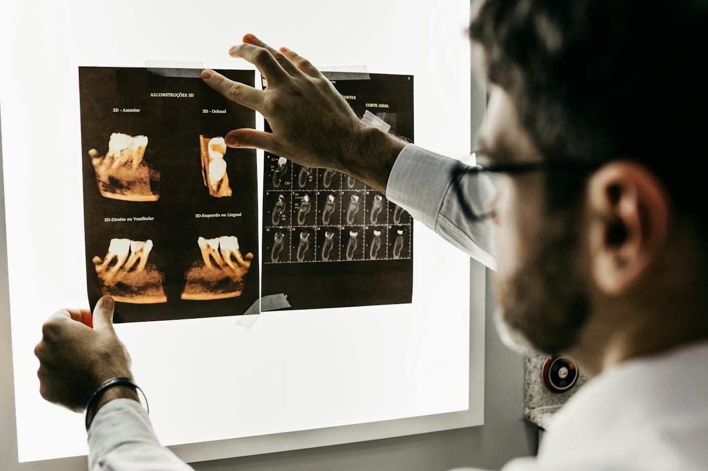 Dentist reviewing dental X-ray images on a light panel